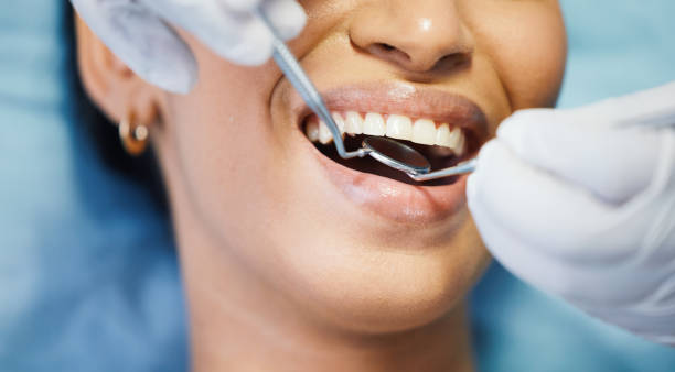 Best Emergency Broken Tooth Repair in Brownsville, TX