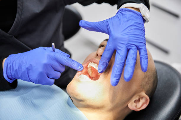 Best Emergency Tooth Extraction in Brownsville, TX