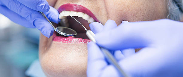 Best Emergency Root Canal Treatment in Brownsville, TX