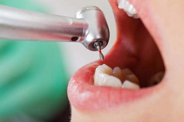 Best Walk-In Emergency Dentist in Brownsville, TX